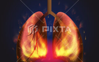 Lung Burning