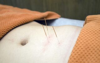 fear of trying acupuncture